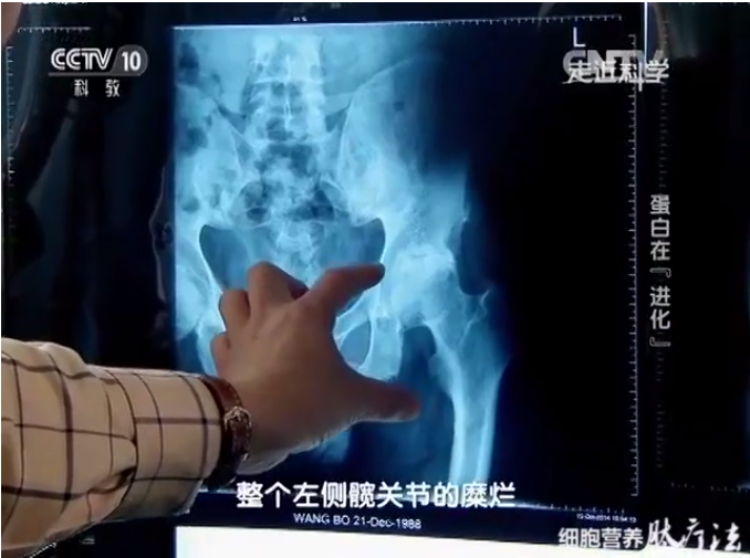 小分子肽对股骨头坏死的作用.png