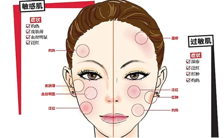 干细胞疗法对皮肤过敏效果好吗，干细胞能修复感性性皮肤吗