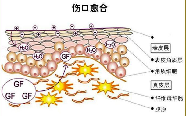 胶原蛋白肽促进伤口愈合特别适合糖尿病足人群服用