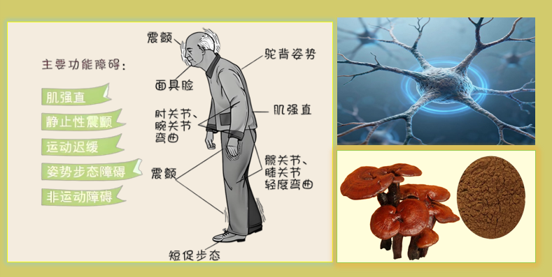 灵芝多糖对帕金森病的作用.png 灵芝多糖对帕金森病的作用.png